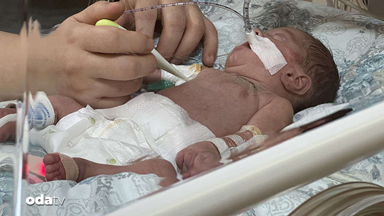 bir yenidogan skandali daha ilacla erken dogum qNBYpzky