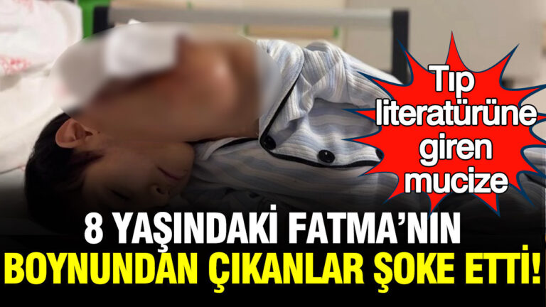 tip-literaturune-giren-mucize-8-yasindaki-fatmanin-boynundan-cikanlar-soke-etti-idFtxWfG
